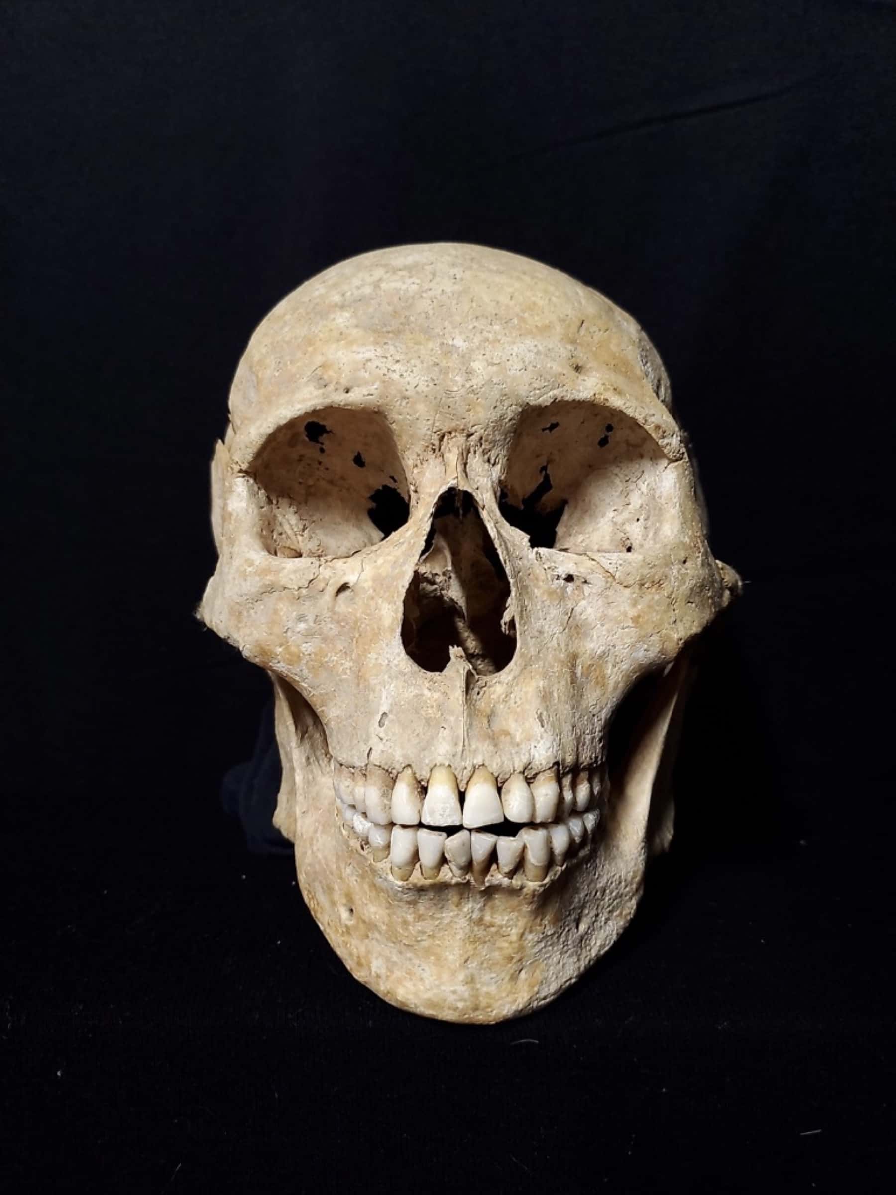 SchaedelIMG 20211214