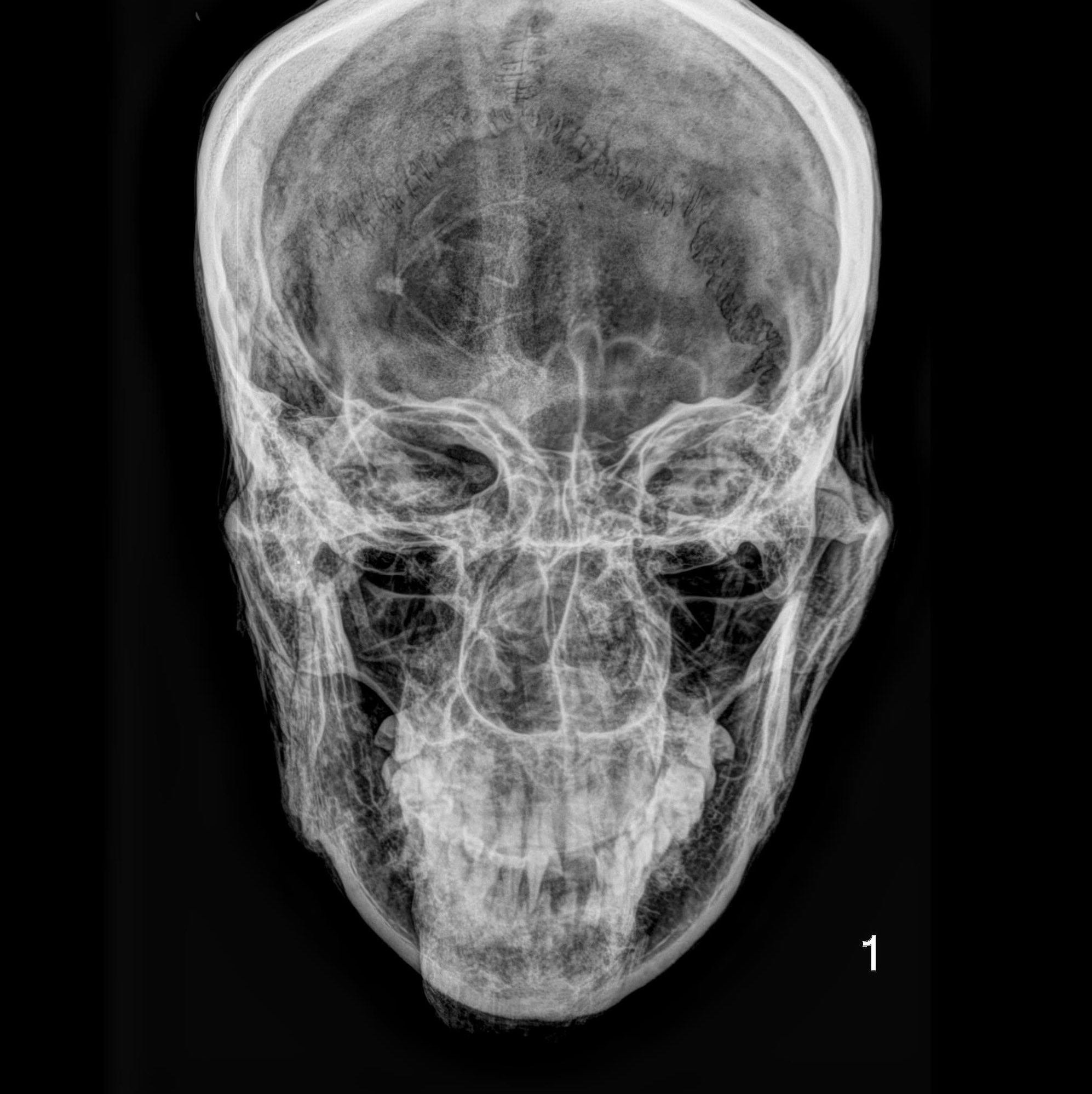Radiocarbon analysis reference image 3