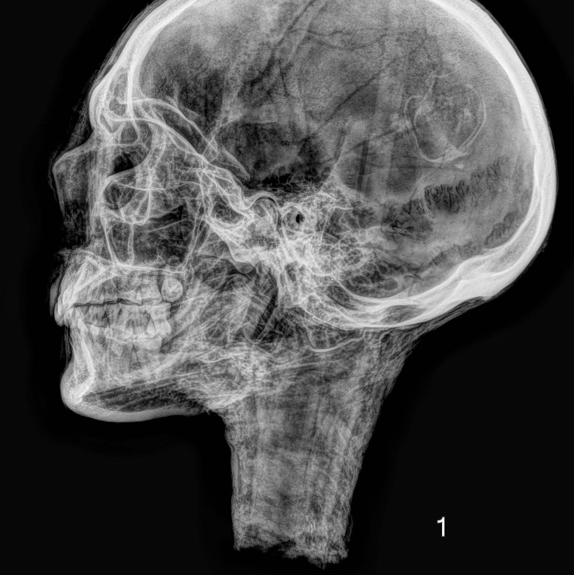 Radiocarbon analysis reference image 4