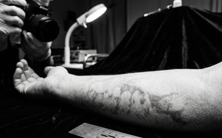 Forensic livor mortis documentation, formation and significance of corpse stains in forensic photography
