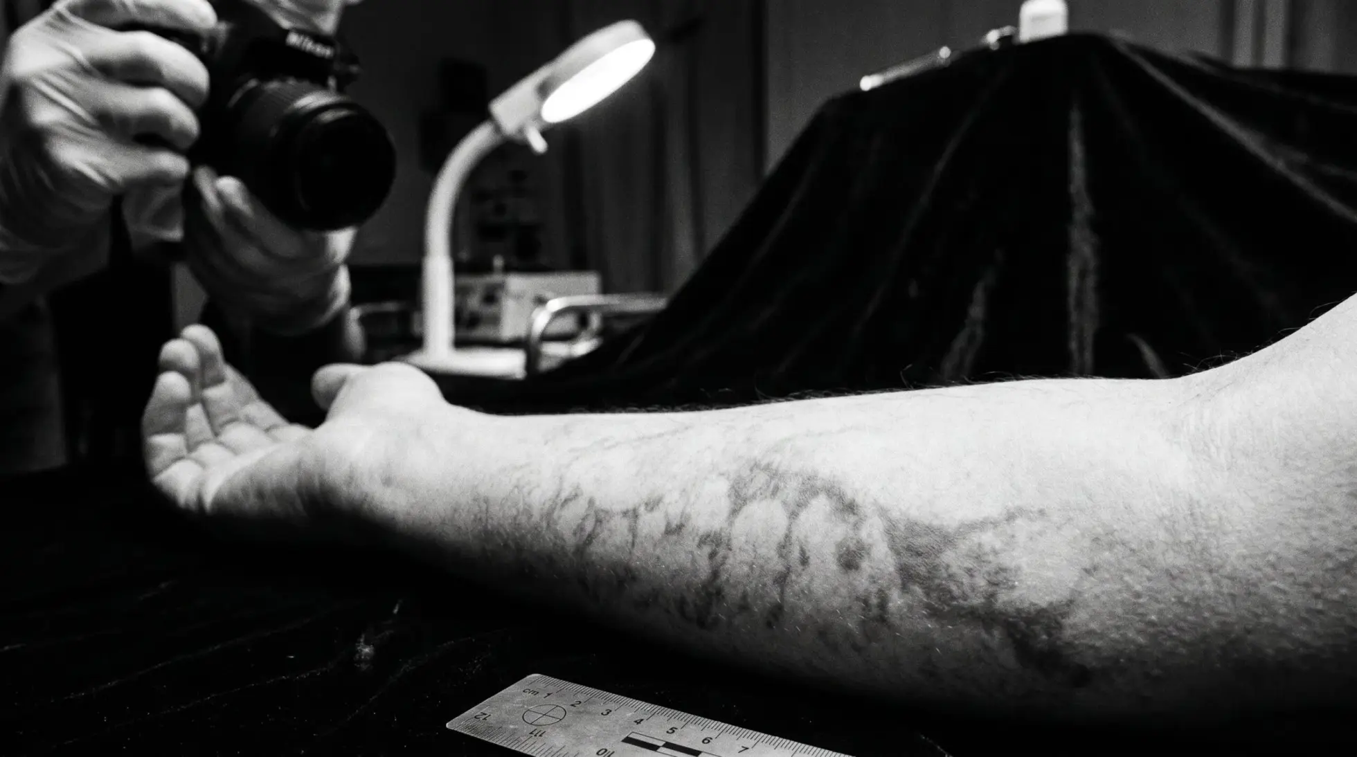 Forensic livor mortis documentation, formation and significance of corpse stains in forensic photography